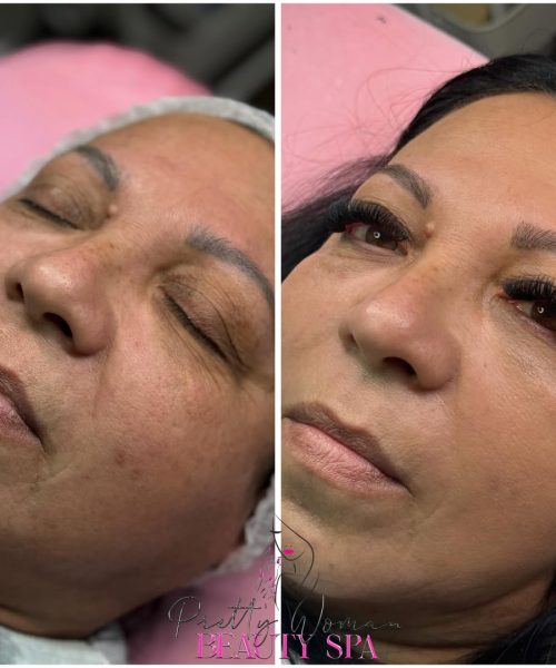FACIAL~1