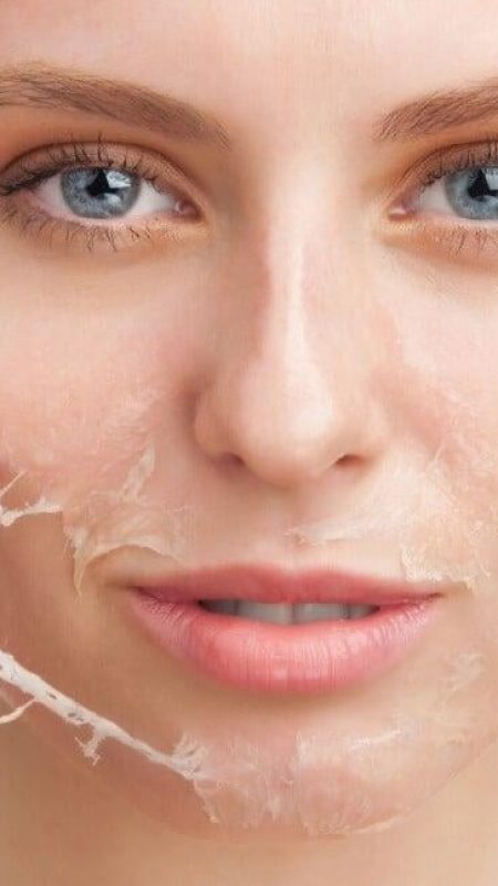 peeling peeling